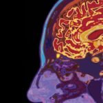 When Can Alzheimer’s Be Diagnosed?