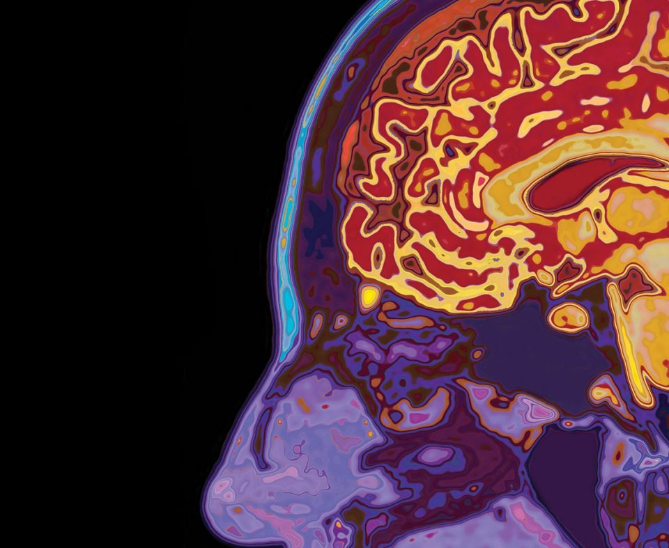 When Can Alzheimer’s Be Diagnosed?